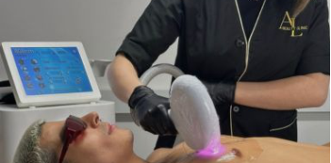 Laser Hair Removal